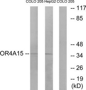 Western blot analysis of extracts from COLO cells and HepG2 cells, using OR4A15 antibody.The lane on the right is treated with the synthesized peptide.