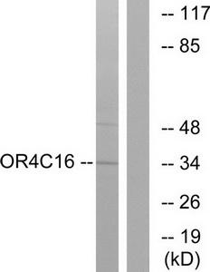 Western blot analysis of extracts from LOVO cells, using OR4C16 antibody.The lane on the right is treated with the synthesized peptide.