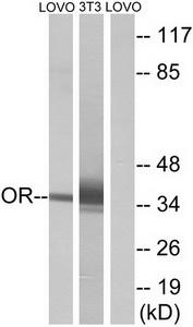 Western blot analysis of extracts from LOVO cells and NIH-3T3 cells, using OR antibody.The lane on the right is treated with the synthesized peptide.