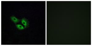 Immunofluorescence analysis of A549 cells, using OR4E2 antibody.The picture on the right is treated with the synthesized peptide.