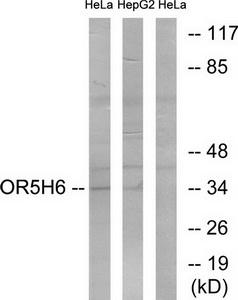 Western blot analysis of extracts from HeLa cells and HepG2 cells, using OR5H6 antibody.The lane on the right is treated with the synthesized peptide.