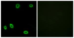 Immunofluorescence analysis of HuvEc cells, using OR5L1/2 antibody.The picture on the right is treated with the synthesized peptide.