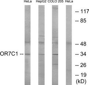 Western blot analysis of extracts from HeLa cells, HepG2 cells and COLO cells, using OR7C1 antibody.The lane on the right is treated with the synthesized peptide.