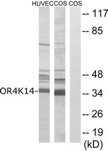 Western blot analysis of extracts from COS-7 cells and HUVEC cells, using OR4K14 antibody.The lane on the right is treated with the synthesized peptide.