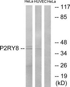Western blot analysis of extracts from HeLa cells and HUVEC cells, using P2RY8 antibody.The lane on the right is treated with the synthesized peptide.
