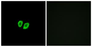 Immunofluorescence analysis of A549 cells, using RXFP4 antibody.The picture on the right is treated with the synthesized peptide.