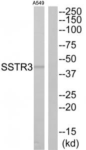 Western blot analysis of extracts from A549 cells, using SSTR3 antibody.The lane on the right is treated with the synthesized peptide.