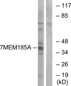 Western blot analysis of extracts from K562 cells, using TMEM185A antibody.The lane on the right is treated with the synthesized peptide.