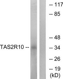 Western blot analysis of extracts from LOVO cells, using TAS2R10 antibody.The lane on the right is treated with the synthesized peptide.