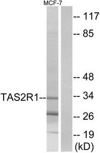 Western blot analysis of MYPT1 (Phospho-Thr853) expression in NIH/3T3 cell extract