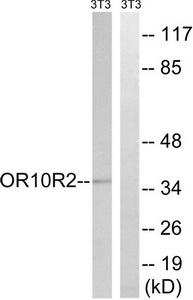 Western blot analysis of extracts from 3T3 cells, using MAGEA5 antibody.The lane on the right is treated with the synthesized peptide.