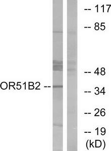 Western blot analysis of extracts from HT-29 cells, using OR51B2 antibody.The lane on the right is treated with the synthesized peptide.