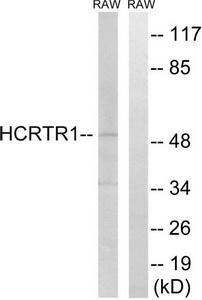 Western blot analysis of extracts from RAW264.7 cells, using HCRTR1 antibody.The lane on the right is treated with the synthesized peptide.