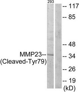 Western blot analysis of extracts from 293 cells, treated with etoposide (25uM, 1hour), using MMP23 (Cleaved-Tyr79) antibody.The lane on the right is treated with the synthesized peptide.