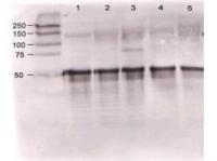 Gel: 6%SDS-PAGE<br>Lysate: 40 μg<br>Lane 1-2: A172 cells<br>231 cells<br>Primary antibody: TA350402 (SENP7 Antibody) at dilution 1/800<br>Secondary antibody: Goat anti rabbit IgG at 1/8000 dilution<br>Exposure time: 30 seconds