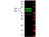 WB using Anti-Cyclin T2 (Rabbit) to detect two major bands (arrowheads) corresponding to human Cyclin T2a and T2b as indicated. The primary antibody diluted to 1:500 in 5% BLOTTO in PBS. The membrane was washed and reacted with a 1:10,000 dilution of IRDye™800 conjugated Gt-a-Rabbit IgG [H&L] for 45 min at RT. Molecular weight estimation was made by comparison to prestained MW markers indicated at the right (700 nm channel, red).