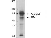 Anti-Cenexin-1 in Western Blot using Immunochemicals Protein A Purified Anti-Cenexin-1 antibody shows detection of Cenexin-1 in total cell lysates from mouse F9 embryonic carcinoma cells. Arrowheads show detection of Cenexin-1 at approximately 93kDa and Outer dense fiber protein 2 (ODF2) at approximately 70kDa. In personal communication with K. Lee, CCR-NCI, Bethesda, MD.