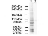WB using Anti-AP1G1 antibody shows strong detection of a 91-kDa band corresponding to Human AP1G1 in a HeLa whole cell lysate (lane 1). Peptide competition (using 1 ug/ml of the immunizing peptide) blocks the specific reactivity of this antibody with AP1G1 (lane 2). Approximately 20 ug of each lysate. Primary antibody was used at 1:500. Detection occurred using a 1:5,000 dilution of HRP-labeled Rabbit anti-Goat IgG.