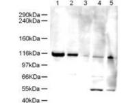 WB using Anti-Elg1 antibody shows detection of a band ~120 kDa corresponding to human Elg1 (arrowhead) in various cell lysates. Lanes contain ~5 ug of HeLa nuclear extract (1), HeLa (2), A431 (3), Jurkat (4) and HEK293 (5) whole cell lysates. Primary antibody was used at 1:500. The expected molecular weight of Elg1 is 120kDa according to Kanellis P et al. 2003. The 50kD bands in Jurkat and 293 cell lysates are probably cross-reaction with other proteins.