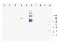 WB using Anti-Ankrd26 antibody shows detection of a band at ~81 kDa corresponding to mouse Ankrd26 protein. Lane 1 Blank, Lane 2 MES cell lysate - 80 ug, Lane 3 MES cell lysate - 40 ug, Lane 4 293T-ANKRD26 transfected cell lysate - 20 ug, Lane 5 control 293T cell lysate - 20 ug, Lane 6 BSA-ANKRD26 conjugate 20 ng, Lane 7 BSA - 500 ng, Lane 8 BSA - 100 ng, Lane 9 BSA 20 ng and Lane 10 Protein standards.Primary antibody diluted to 1:1,000 and ALP conjugated Gt-a-Rabbit IgG at 1:3,000.