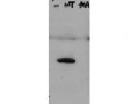 WB of Rabbit Anti-Hice1 pS70 antibody. Lane 1: HeLa cell extracts of untransfected cells (-). Lane 2: transfected HeLa cell extracts with Flag X3-Hice1 WT (WT). Lane 3: transfected HeLa cell extracts with Flag X3-Hice1 S70A mutant (70A). Load: 35 ug per lane. Primary antibody: Hice1 pS70 antibody at 0.5 ug/mL for overnight at 4°C. Secondary antibody: IRDye800™ Conjugated Goat Anti-Rabbit IgG secondary antibody at 1:10,000 for 45 min at RT.