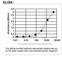 ELISA: ADCYAP1 Antibody