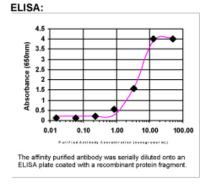 ELISA: SCN3B Antibody