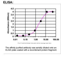 ELISA: KIAA0196 Antibody