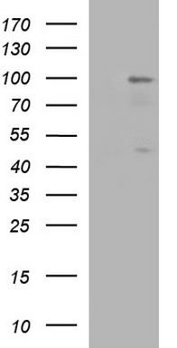 HEK293T cells were transfected with the pCMV6-ENTRY control (Left lane) or pCMV6-ENTRY SHBG (RC228307, Right lane) cDNA for 48 hrs and lysed. Equivalent amounts of cell lysates (5 ug per lane) were separated by SDS-PAGE and immunoblotted with anti-SHBG. Positive lysates LY431335 (100 ug) and LC431335 (20 ug) can be purchased separately from OriGene.