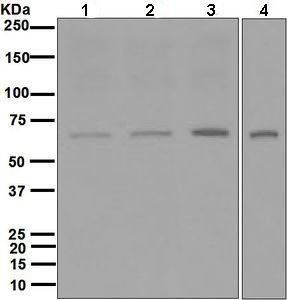 WB Suggested Anti-PRKAR1A Antibody Titration: 0.2-1ug/ml; ELISA Titer: 1:62500; Positive Control: Human Liver