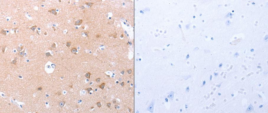 Predicted cell location: Cytoplasm. Positive control: Human brain and lung cancer tissue. Recommended dilution: 1/25-100 The image on the left is immunohistochemistry of paraffin-embedded human brain tissue using SPAG4 antibody at dilution 1/30, on the right is treated with the synthetic peptide. (Original magnification:x 200)
