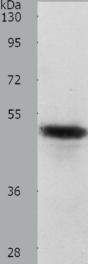 Predicted band size: 45 kDa. Positive control: Human liver cancer tissue lysate. Recommended dilution: 1/500-2000. (Gel: 10%SDS-PAGE Lysate: 40 ug per lane Primary antibody: 1/750 dilution Secondary antibody: Goat anti Rabbit IgG - H&L (HRP) at 1/10000 dilution Exposure time: 40 seconds)