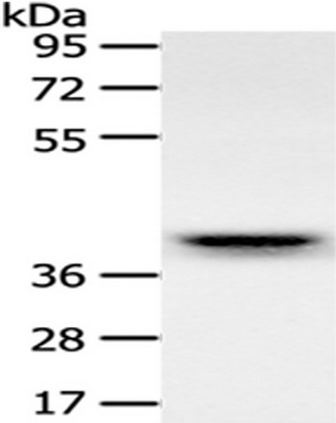 Gel: 10%SDS-PAGE, Lysate: 40 ug, Primary antibody: (RFC2 Antibody) at dilution 1/500 dilution, Secondary antibody: Goat anti rabbit IgG at 1/8000 dilution, Exposure time: 20 seconds