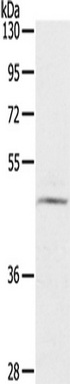Gel: 8%SDS-PAGE, Lysate: 40 ug, Lane: TM4 cells, Primary antibody: (CERS3 Antibody) at dilution 1/200, Secondary antibody: Goat anti rabbit IgG at 1/8000 dilution, Exposure time: 3 minutes