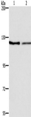 Gel: 6%SDS-PAGE, Lysate: 40 ug, Lane 1-2: NIH/3T3 cells, LoVo cells, Primary antibody: (ATP2A1 Antibody) at dilution 1/500, Secondary antibody: Goat anti rabbit IgG at 1/8000 dilution, Exposure time: 3 minutes