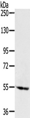 Gel: 6%SDS-PAGE, Lysate: 40 ug, Primary antibody: (SNX1 Antibody) at dilution 1/200 dilution, Secondary antibody: Goat anti rabbit IgG at 1/8000 dilution, Exposure time: 1 minute