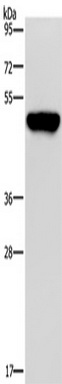 Western blot analysis of extracts of normal 293T cells and 293T transfected with NSP4 Protein, using SARS-CoV-2 NSP4 antibody (TA379342) at 1:1000 dilution.|Secondary antibody: HRP Goat Anti-Rabbit IgG (H+L) at 1:10000 dilution.|Lysates/proteins: 25ug per lane.|Blocking buffer: 3% nonfat dry milk in TBST.|Detection: ECL Basic Kit .|Exposure time: 90s.