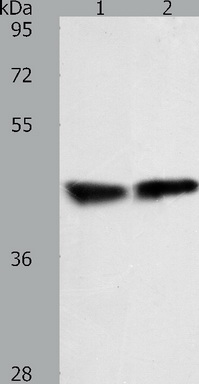 Predicted band size: 41 kDa. Positive control: Human fetal lung and mouse lung tissue lysate. Recommended dilution: 1/200-1000. (Gel: 10%SDS-PAGE Lane 1: Human fetal lung tissue lysate Lane 2: Mouse lung tissue lysate Lysates: 40 ug per lane Primary antibody: 1/100 dilution Secondary antibody: Goat anti Rabbit IgG - H&L (HRP) at 1/10000 dilution Exposure time: 2 minutes)