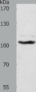 Predicted band size: 121 kDa. Positive control: NIH/3T3 cell lysate. Recommended dilution: 1/500-2000. (Gel: 8%SDS-PAGE Lysate: 40 ug per lane Primary antibody: 1/1300 dilution Secondary antibody: Goat anti Rabbit IgG - H&L (HRP) at 1/10000 dilution Exposure time: 1 hour)