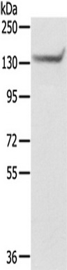 Gel: 6%SDS-PAGE, Lysate: 40 ug, Primary antibody: (SASH1 Antibody) at dilution 1/200 dilution, Secondary antibody: Goat anti rabbit IgG at 1/8000 dilution, Exposure time: 5 seconds