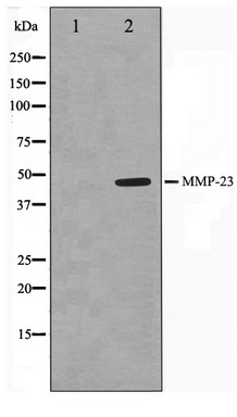 Western blot analysis on SK-OV3 cell lysate using MMP23 Antibody