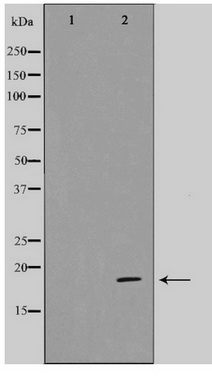 Western blot analysis on HeLa cell lysate using CDKAP1 Antibody
