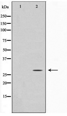 Western blot analysis on HuvEc cell lysate using ANP32C Antibody