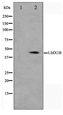 Western blot analysis on Jurkat cell lysate using LMX1B Antibody