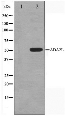Western blot analysis on COLO205 cell lysate using ADA2L Antibody