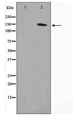Western blot analysis on COLO205 cell lysate using MN1 Antibody