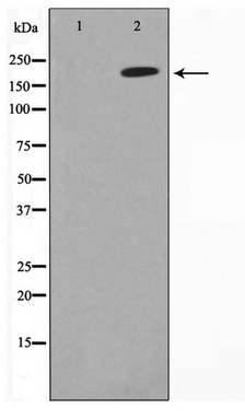 Western blot analysis of extracts of various cell lines, using MonoMethyl-Histone H3-K36 antibody (TA376903) at 1:1000 dilution.|Secondary antibody: HRP Goat Anti-Rabbit IgG (H+L) at 1:10000 dilution.|Lysates/proteins: 25ug per lane.|Blocking buffer: 3% nonfat dry milk in TBST.|Detection: ECL Basic Kit .|Exposure time: 1s.