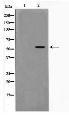 Western blot analysis on Jurkat cell lysate using ZNF187 Antibody