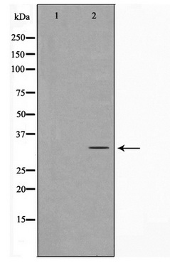 Western blot analysis on Jurkat cell lysate using MAST4 Antibody