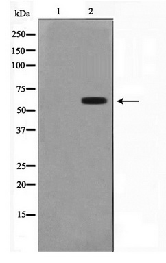 Western blot analysis of extracts of various cell lines, using Acetyl-Histone H2B-K12 antibody (TA377050) at 1:1000 dilution.HeLa cells and C2C12 cells and C6 cells were treated by TSA (1 uM) at 37℃ for 18 hours.|Secondary antibody: HRP Goat Anti-Rabbit IgG (H+L) at 1:10000 dilution.|Lysates/proteins: 25ug per lane.|Blocking buffer: 3% nonfat dry milk in TBST.|Detection: ECL Basic Kit .|Exposure time: 90s.